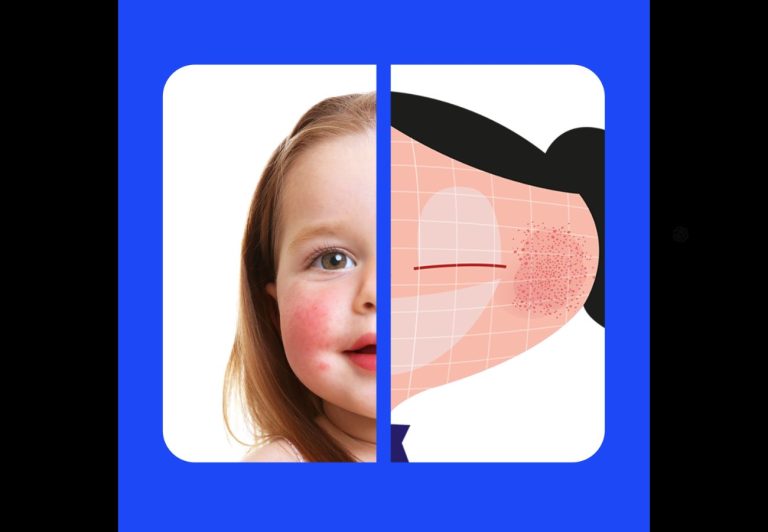 “Muestra tu Marca”: BBDO y Bayer relatan la historia de “Luna” en la nueva campaña de Bepanthen